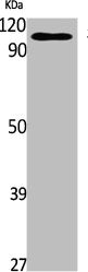 Western Blot analysis of K562 cells using Stat2 Polyclonal Antibody