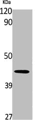 Western Blot analysis of Jurkat cells using Sox-17 Polyclonal Antibody