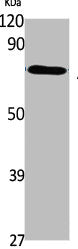 Western Blot analysis of K562 cells using ABCG1 Polyclonal Antibody