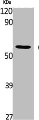 Western Blot analysis of K562 cells using CaMKIIδ Polyclonal Antibody