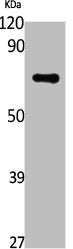 Western Blot analysis of Jurkat cells using DNA pol ε B Polyclonal Antibody