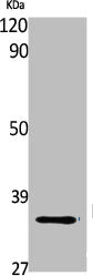 Western Blot analysis of Jurkat cells using FAIM2 Polyclonal Antibody