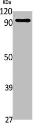 Western Blot analysis of Jurkat cells using G-CSFR Polyclonal Antibody