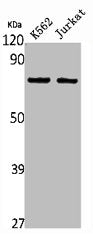 Western Blot analysis of K562 Jurkat cells using HGFA Polyclonal Antibody