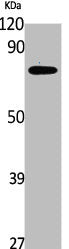 Western Blot analysis of Jurkat cells using SLP-76 Polyclonal Antibody