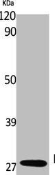 Western Blot analysis of K562 cells using Rab 26 Polyclonal Antibody