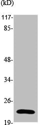 Western Blot analysis of Jurkat cells using Stathmin-2 Polyclonal Antibody