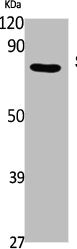Western Blot analysis of Jurkat cells using SV2C Polyclonal Antibody