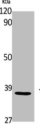 Western Blot analysis of Jurkat cells using TCF-19 Polyclonal Antibody