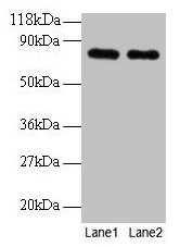 Western blot All lanes: Rat Transferrin antibody at 2µg/ml Lane 1: Rat Transferrin at 0.2 mg Lane 2: Rat Transferrin at 0.1 mg Secondary Goat polyclonal to rabbit IgG at 1/15000 dilution Predicted band size: 77, 55 kDa Observed band size: 77 kDa