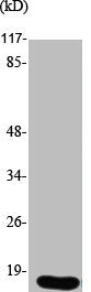 Western Blot analysis of Jurkat cells using UBE2A/B Polyclonal Antibody