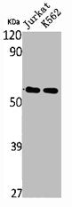 Western Blot analysis of Jurkat K562 cells using SS-56 Polyclonal Antibody