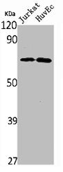 Western Blot analysis of Jurkat HuvEc cells using HNF-1β Polyclonal Antibody