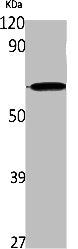 Western Blot analysis of K562 cells using IL-28Rα Polyclonal Antibody