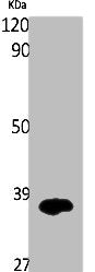 Western Blot analysis of K562 cells using IL-12A p35 Polyclonal Antibody