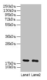 Western blot All lanes: UBE2I antibody at 2µg/ml Lane 1: 293T whole cell lysate Lane 2: EC109 whole cell lysate Secondary Goat polyclonal to rabbit IgG at 1/15000 dilution Predicted band size: 19 kDa Observed band size: 19 kDa