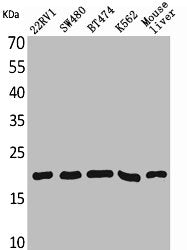 Western Blot analysis of 22RV-1 SW480 BT474 K562 mouse liver cells using VEGF-A Polyclonal Antibody