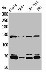 Western Blot analysis of BT474 A549 SHSY5Y 293 cells using K-cadherin Polyclonal Antibody