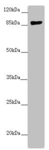 Western blot All lanes: CCHCR1 antibody at 2.67 ug/ml + 293T whole cell lysate Secondary Goat polyclonal to rabbit IgG at 1/10000 dilution Predicted band size: 89, 100, 96 kDa Observed band size: 89 kDa