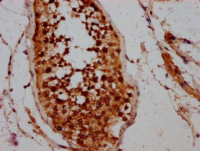 IHC image of CSB-PA004770LA01HU diluted at 1:200 and staining in paraffin-embedded human testis tissue performed on a Leica BondTM system. After dewaxing and hydration, antigen retrieval was mediated by high pressure in a citrate buffer (pH 6.0)....