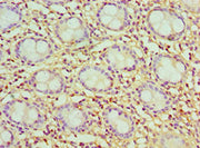 Immunohistochemistry of paraffin-embedded human colon tissue using CSB-PA004771ESR2HU at dilution of 1:100