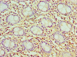 Immunohistochemistry of paraffin-embedded human colon tissue using CSB-PA004771ESR2HU at dilution of 1:100