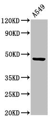 Western Blot Positive WB detected in: A549 whole cell lysate All lanes: CCKAR antibody at 3.4µg/ml Secondary Goat polyclonal to rabbit IgG at 1/50000 dilution Predicted band size: 48 kDa Observed band size: 48 kDa