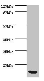 Western blot All lanes: CCL11 antibody at 5ug/ml + Hela whole cell lysate Secondary Goat polyclonal to rabbit IgG at 1/10000 dilution Predicted band size: 11 kDa Observed band size: 11 kDa