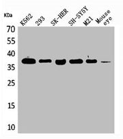 Western Blot analysis of K562 293 SK-HEP-1 SHSY5Y M21 mouse eye cells using RRP7A Polyclonal Antibody