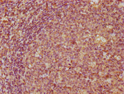 IHC image of CSB-PA004785DA01HU diluted at 1:300 and staining in paraffin-embedded human tonsil tissue performed on a Leica BondTM system. After dewaxing and hydration, antigen retrieval was mediated by high pressure in a citrate buffer (pH 6.0)....