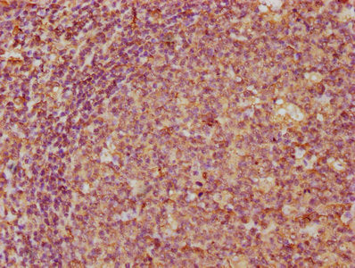 IHC image of CSB-PA004785DA01HU diluted at 1:300 and staining in paraffin-embedded human tonsil tissue performed on a Leica BondTM system. After dewaxing and hydration, antigen retrieval was mediated by high pressure in a citrate buffer (pH 6.0)....