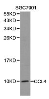 Western blot analysis of extracts of SGC7901 cell lines, using CCL4 antibody.