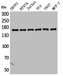 Western Blot analysis of SKOV3 BT474 Jurkat PC-3 U937 MCF7 cells using SCP-2 Polyclonal Antibody