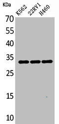 Western Blot analysis of K562 22RV-1 H460 cells using SCP-3 Polyclonal Antibody
