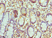 Immunohistochemistry of paraffin-embedded human small intestine tissue using CSB-PA004802ESR1HU at dilution of 1:100
