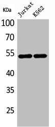 Western Blot analysis of Jurkat K562 cells using HNF-4α/γ Polyclonal Antibody