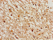 Immunohistochemistry of paraffin-embedded human brain tissue using CSB-PA004804LA01HU at dilution of 1:100
