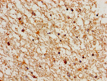 Immunohistochemistry of paraffin-embedded human brain tissue using CSB-PA004804LA01HU at dilution of 1:100