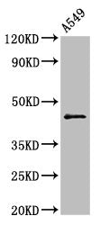 Western Blot Positive WB detected in: A549 whole cell lysate All lanes: CCNB2 antibody at 2.5µg/ml Secondary Goat polyclonal to rabbit IgG at 1/50000 dilution Predicted band size: 46 kDa Observed band size: 46 kDa