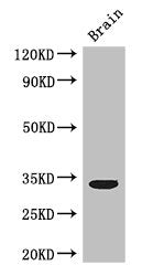 Western Blot Positive WB detected in: Mouse brain tissue All lanes: CCNC antibody at 3ug/ml Secondary Goat polyclonal to rabbit IgG at 1/50000 dilution Predicted band size: 34, 23 kDa Observed band size: 34 kDa