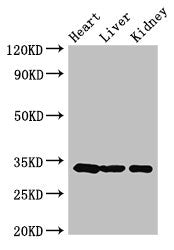 Western Blot Positive WB detected in: Mouse heart tissue, Mouse liver tissue, Mouse kidney tissue All lanes: CCND2 antibody at 3.5ug/ml Secondary Goat polyclonal to rabbit IgG at 1/50000 dilution Predicted band size: 34, 25 kDa Observed band size:...