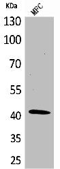 Western Blot analysis of MCF cells using α-SMA Polyclonal Antibody