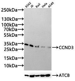 Western Blot Positive WB detected in: K562 whole cell lysate(20µg), JK whole cell lysate(20µg), Raji whole cell lysate(20µg), Hela whole cell lysate(20µg), A549 whole cell lysate(20µg) All lanes:CCND3 antibody at 1:1000 Secondary Goat polyclonal t...