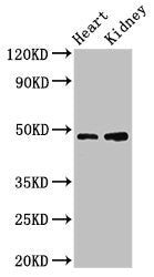Western Blot Positive WB detected in: Mouse heart tissue, Mouse kidney tissue All lanes: CCNE1 antibody at 3.2ug/ml Secondary Goat polyclonal to rabbit IgG at 1/50000 dilution Predicted band size: 48, 42, 46 kDa Observed band size: 48 kDa