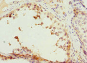 Immunohistochemistry of paraffin-embedded human testis tissue using CSB-PA004818ESR2HU at dilution of 1:100