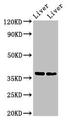 Western Blot Positive WB detected in: Mouse liver tissue, Rat liver tissue All lanes: CCNH antibody at 3ug/ml Secondary Goat polyclonal to rabbit IgG at 1/50000 dilution Predicted band size: 38 kDa Observed band size: 38 kDa