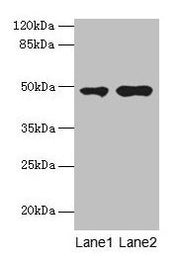 Western blot All lanes: CCNJL antibody at 3µg/ml Lane 1: U251 whole cell lysate Lane 2: Mouse liver tissue Secondary Goat polyclonal to rabbit IgG at 1/10000 dilution Predicted band size: 49, 19 kDa Observed band size: 49 kDa