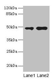 Western blot All lanes: CCNJL antibody at 3µg/ml Lane 1: U251 whole cell lysate Lane 2: Mouse liver tissue Secondary Goat polyclonal to rabbit IgG at 1/10000 dilution Predicted band size: 49, 19 kDa Observed band size: 49 kDa
