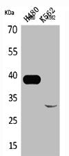 Western Blot analysis of H460 K562 cells using Cathepsin L Polyclonal Antibody