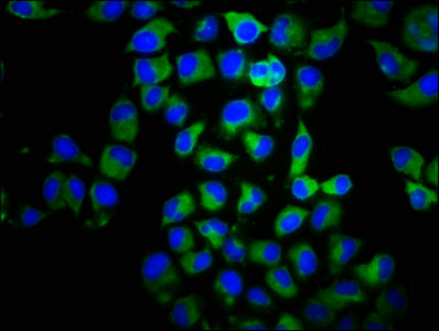 Immunofluorescence staining of Hela cells with CSB-PA004841LA01HU at 1:100, counter-stained with DAPI. The cells were fixed in 4% formaldehyde, permeabilized using 0.2% Triton X-100 and blocked in 10% normal Goat Serum. The cells were then incubat...
